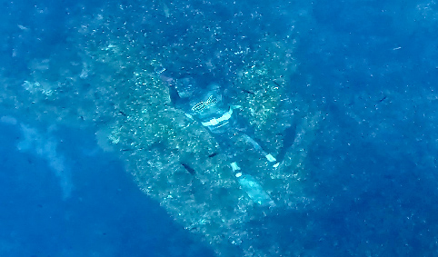 Pressione arteriosa 02