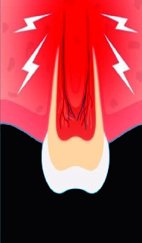 barodontalgie 03